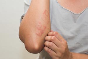7 Signs Your Skin Rash Requires A Trip To Urgent Care