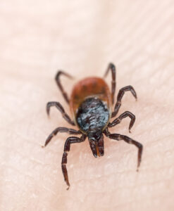 Tick crawling on human skin