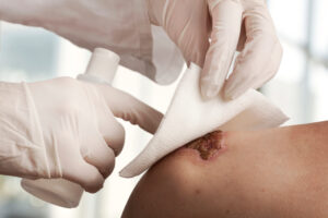 Medical assistant changes the dressing of a wound at the emergency room